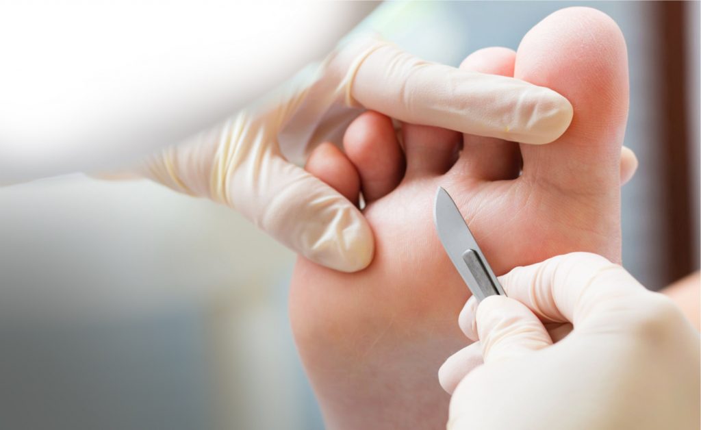 podiatrist st helens