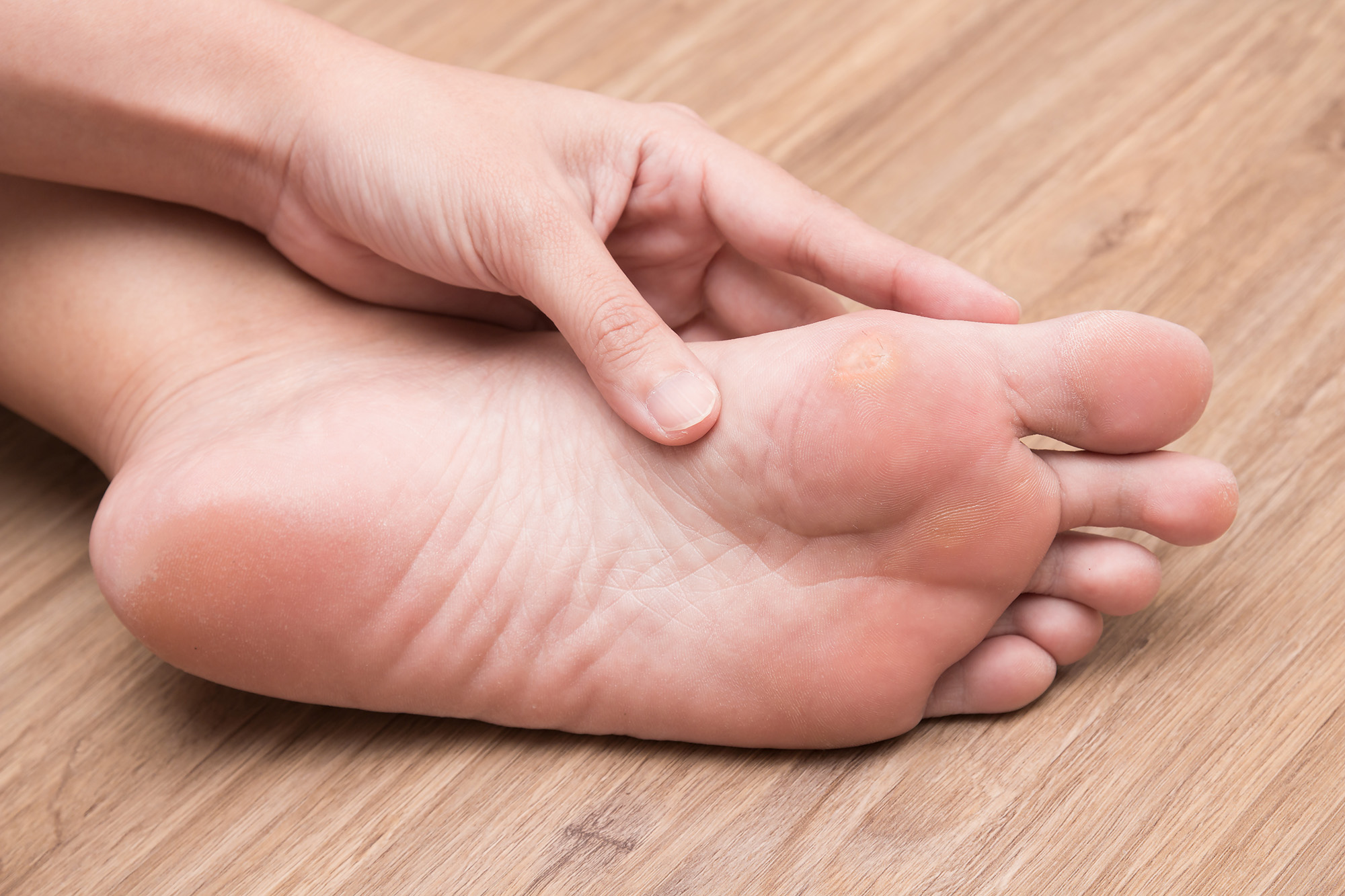 Curacorn treatment results and ongoing management